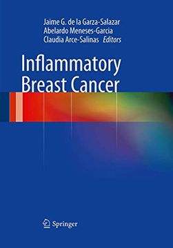 portada Inflammatory Breast Cancer (en Inglés)