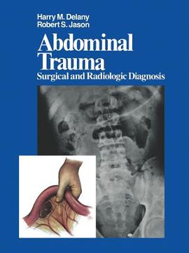 portada Abdominal Trauma: Surgical and Radiologic Diagnosis (en Inglés)