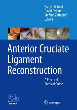 portada Anterior Cruciate Ligament Reconstruction: A Practical Surgical Guide
