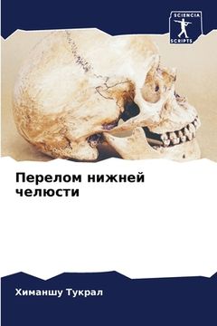 portada Перелом нижней челюсти (en Ruso)