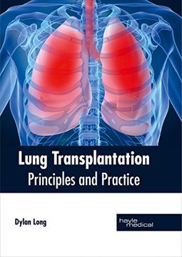 portada Lung Transplantation: Principles and Practice