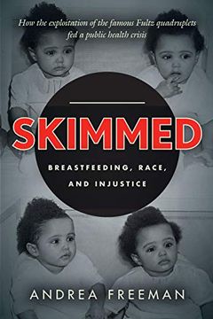 portada Skimmed: Breastfeeding, Race, and Injustice (en Inglés)