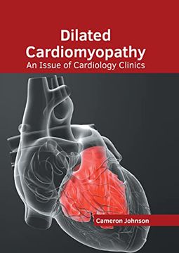 portada Dilated Cardiomyopathy: An Issue of Cardiology Clinics (in English)