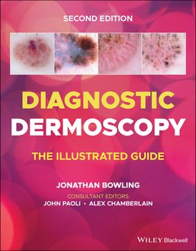 portada Diagnostic Dermoscopy: The Illustrated Guide (en Inglés)