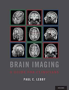 portada Brain Imaging: A Guide for Clinicians (en Inglés)