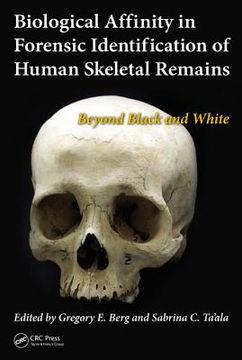 portada biological affinity in forensic identification of human skeletal remains: beyond black and white (en Inglés)