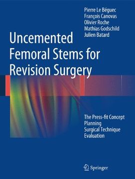 portada Uncemented Femoral Stems for Revision Surgery: The Press-Fit Concept - Planning - Surgical Technique - Evaluation 