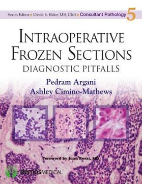 portada Intraoperative Frozen Sections: Diagnostic Pitfalls: 5 (Consultant Pathology Series) (en Inglés)
