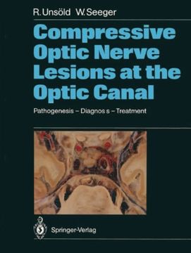 portada compressive optic nerve lesions at the optic canal: pathogenesis diagnosis treatment (en Inglés)