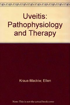 portada Uveitis: Pathophysiology and Therapy (en Inglés)