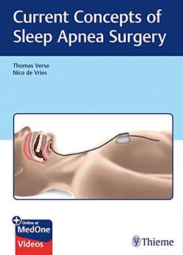 portada Current Concepts of Sleep Apnea Surgery 