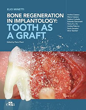 portada Bone Regeneration in Implantology: Tooth as a Graft (en Inglés)