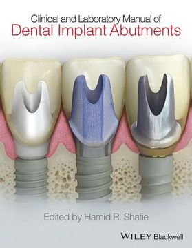 portada Clinical and Laboratory Manual of Dental Implant Abutments (en Inglés)