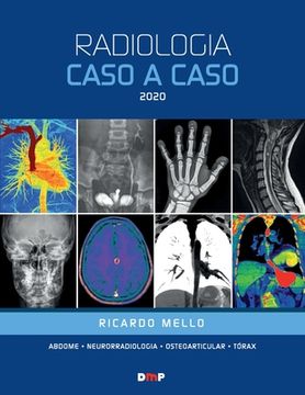portada Radiologia Caso a Caso 2020 (in Portuguese)
