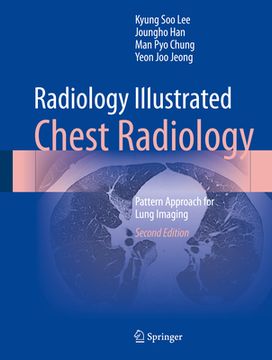 portada Radiology Illustrated: Chest Radiology: Pattern Approach for Lung Imaging (en Inglés)