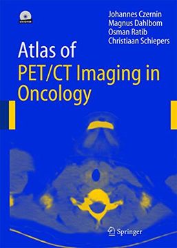 portada Atlas of Pet/Ct Imaging in Oncology (en Inglés)