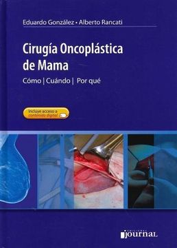 portada Cirugía Oncoplástica de Mama. Cúando. Cómo. Por qué (in Spanish)
