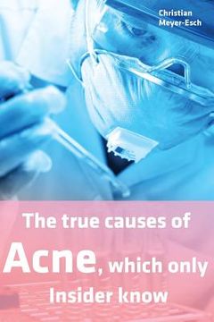 portada The true causes of Acne, which only Insider know (en Inglés)