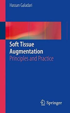 portada Soft Tissue Augmentation: Principles and Practice
