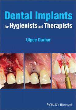 portada Dental Implants for Hygienists and Therapists (en Inglés)