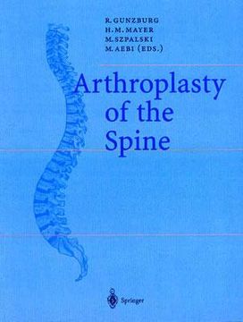 portada arthroplasty of the spine (in English)