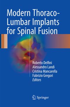 portada Modern Thoraco-Lumbar Implants for Spinal Fusion (en Inglés)