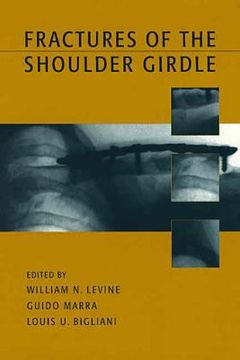 portada fractures of the shoulder girdle (en Inglés)