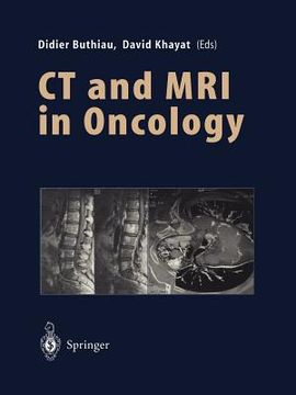 portada ct and mri in oncology (en Inglés)
