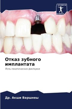 portada Отказ зубного имплантат& (en Ruso)