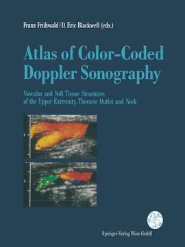 portada atlas of color-coded doppler sonography: vascular and soft tissue structures of the upper extremity, thoracic outlet and neck (en Inglés)
