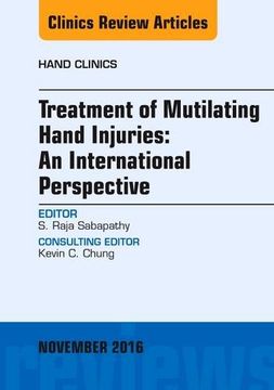 portada 32: Treatment of Mutilating Hand Injuries: An International Perspective, An Issue of Hand Clinics, 1e (The Clinics: Orthopedics)