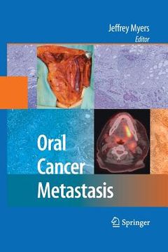 portada Oral Cancer Metastasis (en Inglés)