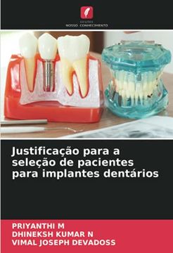 portada Justificação Para a Seleção de Pacientes Para Implantes Dentários (en Portugués)