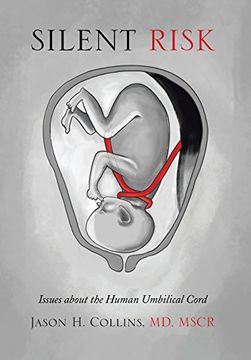 portada Silent Risk: Issues about the Human Umbilical Cord