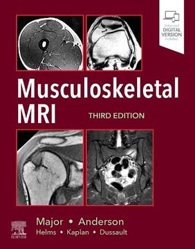 portada Musculoskeletal Mri, 3e (en Inglés)