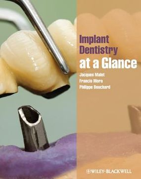 portada implant dentistry at a glance
