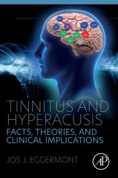 portada Tinnitus and Hyperacusis: Facts, Theories, and Clinical Implications (en Inglés)