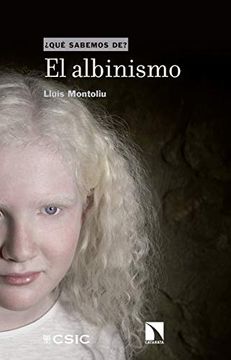 portada El Albinismo: 104 (Qué Sabemos de)