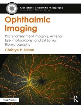 portada Ophthalmic Imaging: Posterior Segment Imaging, Anterior Eye Photography, and Slit Lamp Biomicrography