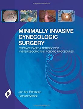 portada Minimally Invasive Gynecologic Surgery: Evidence-Based Laparoscopic, Hysteroscopic & Robotic Surgeries