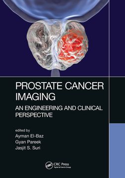 portada Prostate Cancer Imaging: An Engineering and Clinical Perspective (en Inglés)