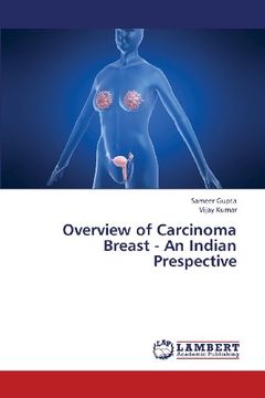 portada overview of carcinoma breast - an indian prespective (en Inglés)
