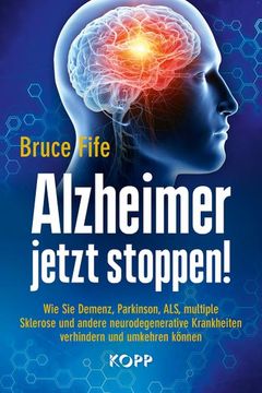 portada Alzheimer Jetzt Stoppen! (en Alemán)