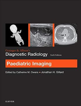 portada Grainger & Allison’S Diagnostic Radiology: Paediatric Imaging (en Inglés)