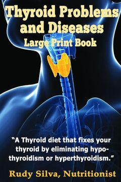 portada Thyroid Problems and diseases: Large Print Book: A Thyroid Diet That Fixes Your Thyroid by eliminating hypothyroidism or hyperthyroidism (en Inglés)