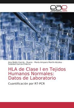 portada Hla de Clase i en Tejidos Humanos Normales: Datos de Laboratorio: Cuantificación por Rt-Pcr (in Spanish)
