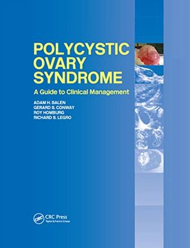 portada Polycystic Ovary Syndrome: A Guide to Clinical Management (in English)