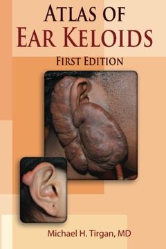 portada Atlas of Ear Keloids