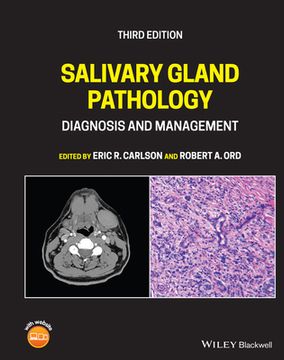 portada Salivary Gland Pathology: Diagnosis and Management (en Inglés)