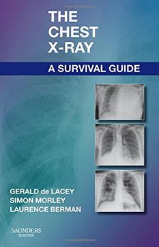 portada The Chest X-Ray: A Survival Guide, 1e (in English)